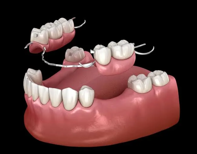 Dentures in Istanbul