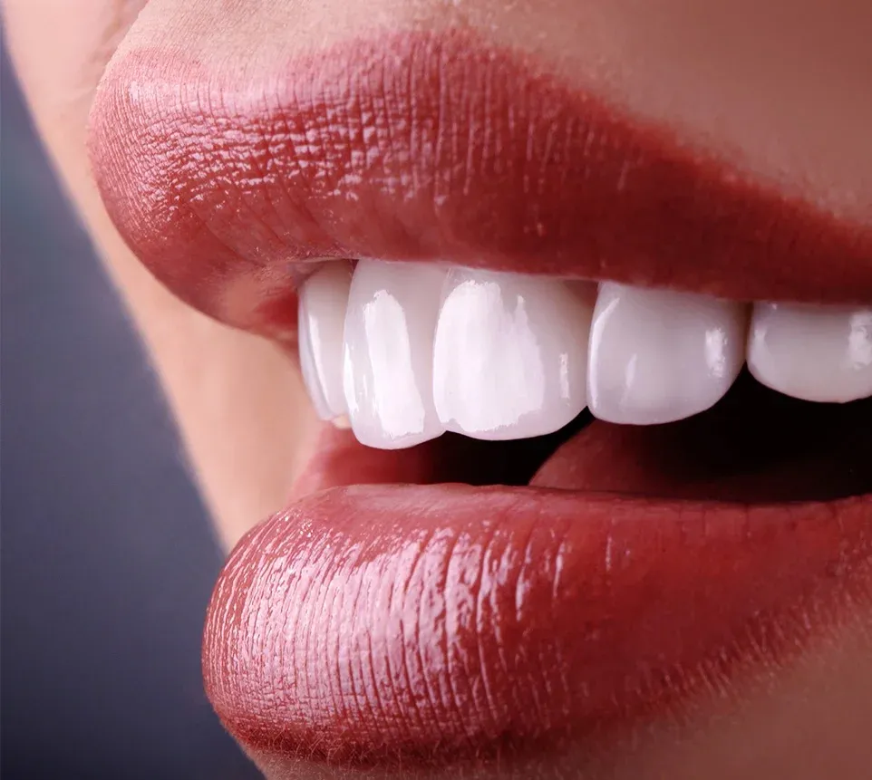 Full-Mouth Reconstruction