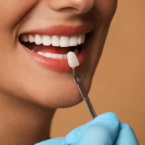 Hollywood Smile & Smile Makeover