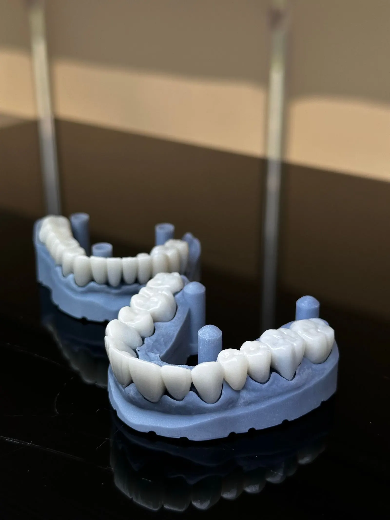 Dental bridge on a working model