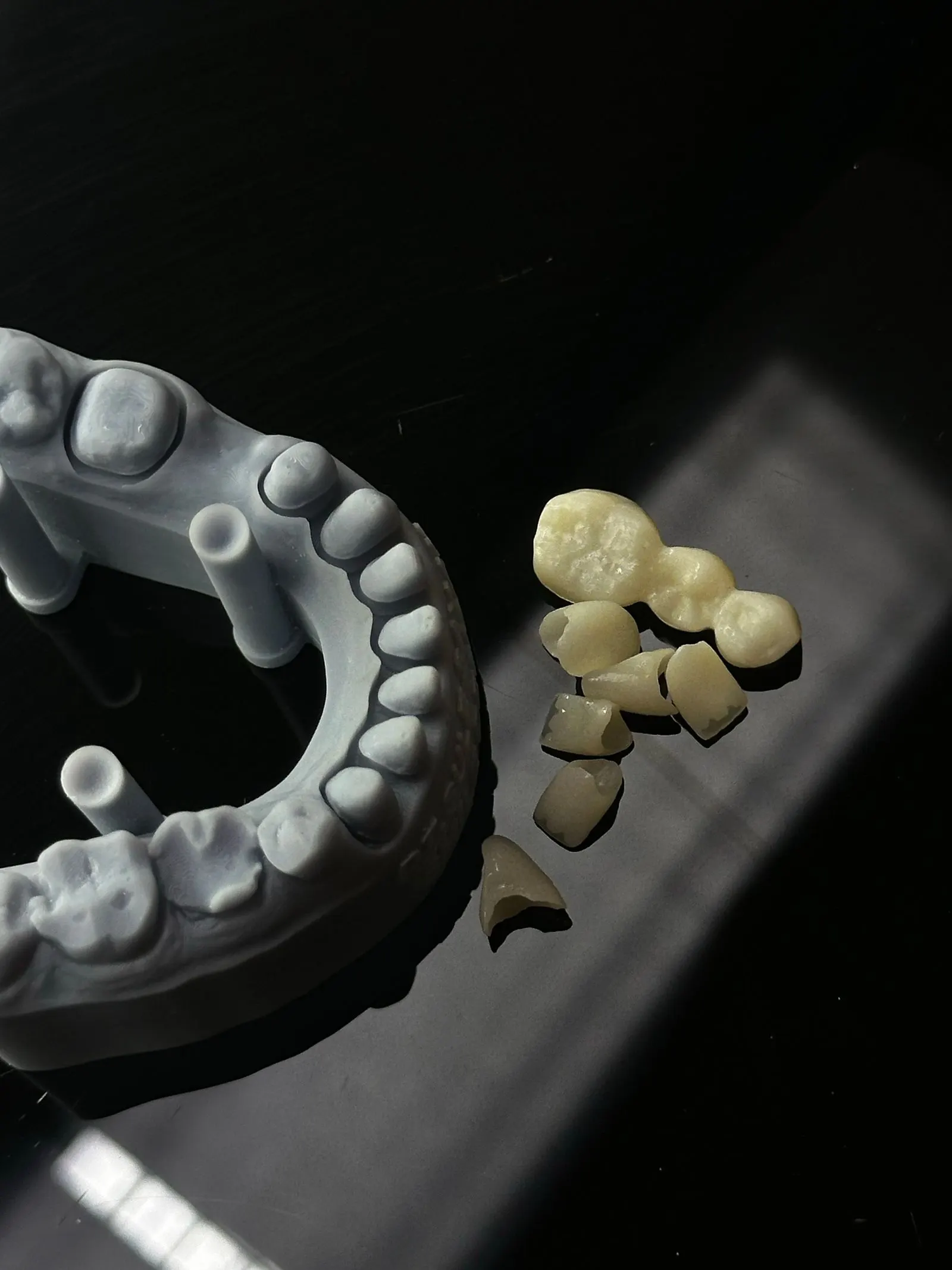 Ceramic crowns next to a dental model