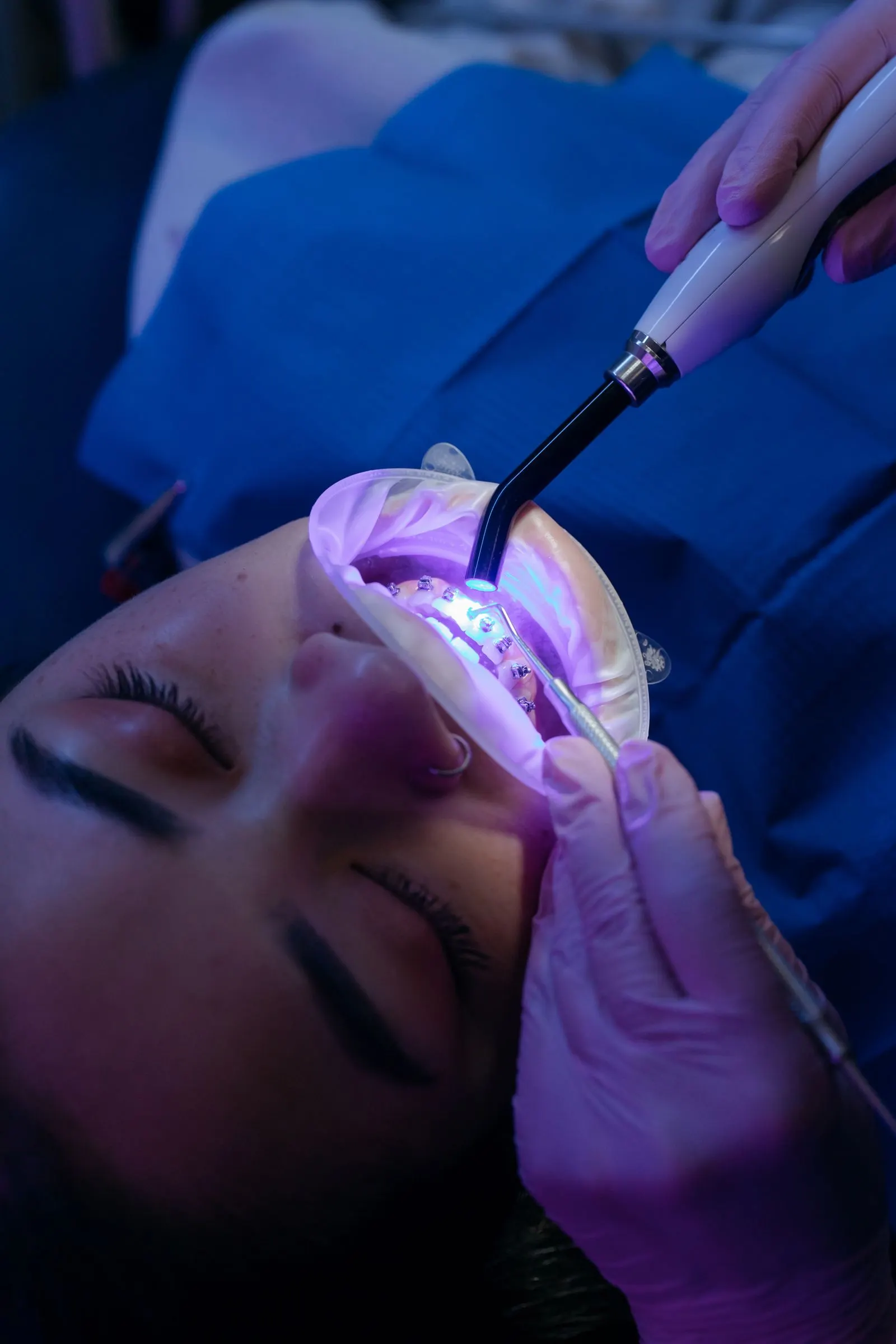 Curing light hardening a composite restoration