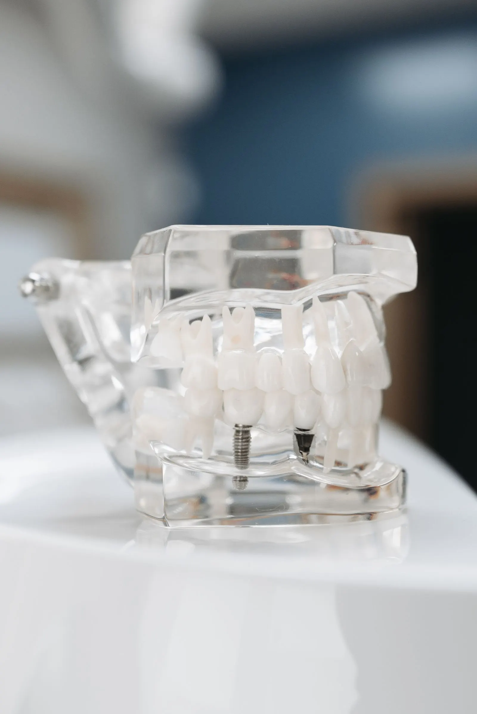 Transparent jaw model with implant screws
