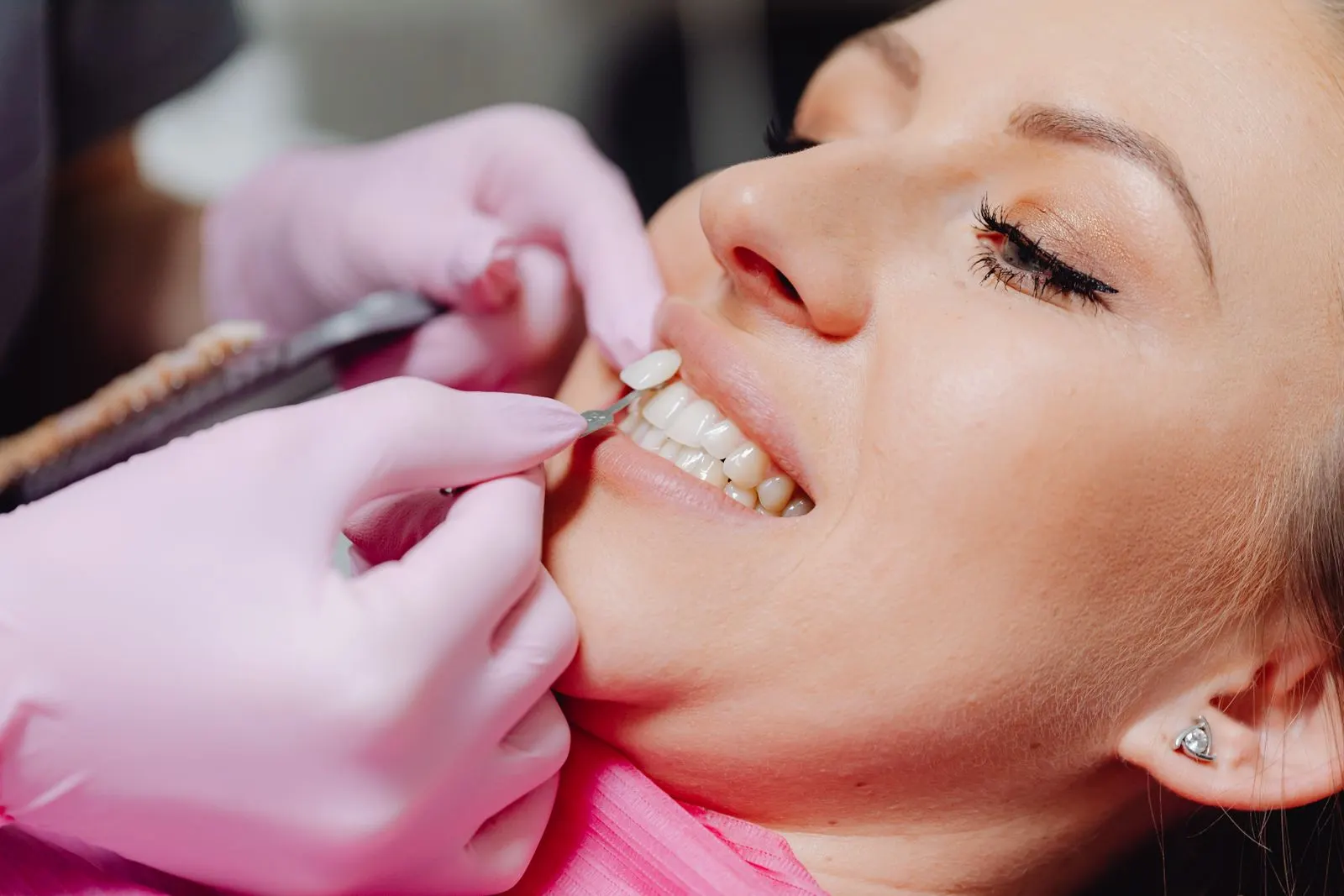 Dentist trying a veneer on a patient’s tooth