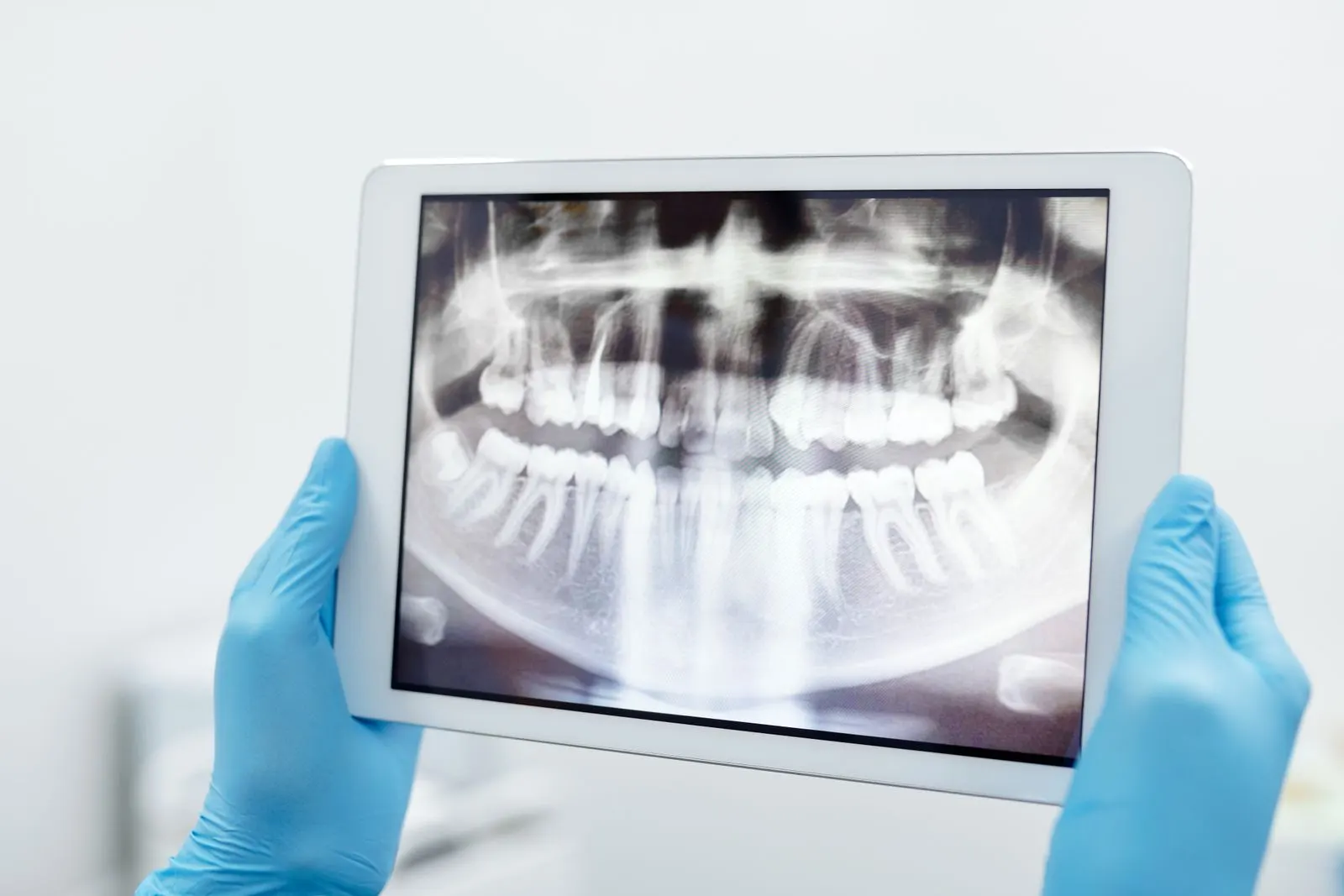 Panoramic X-ray on a tablet